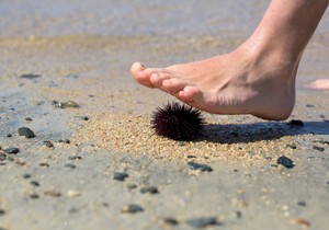 Kontakt sa morskim ježevima može da bude izuzetno bolan