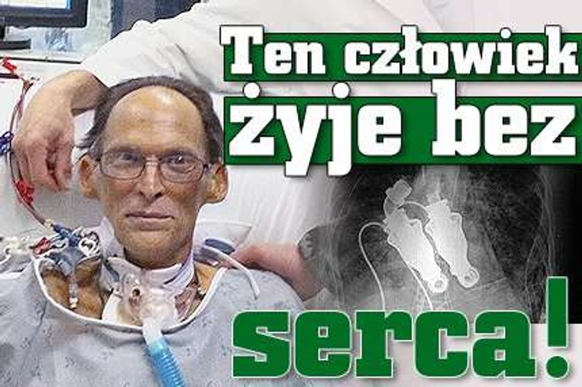 Ten człowiek żyje bez serca