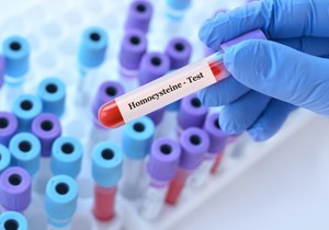 Homocistein pomaže u stvaranju proteina 