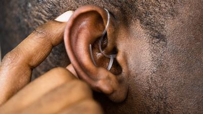 Deafness: Causes, treatment, and management [UF Health]