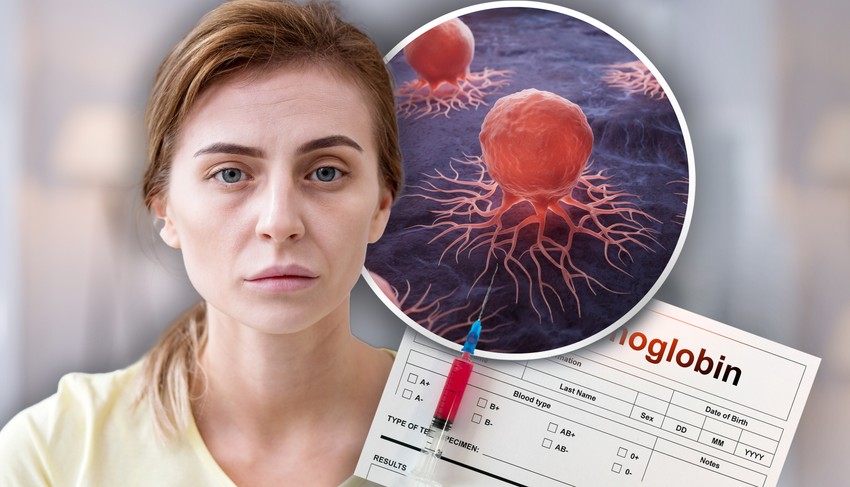 Do anemije mogu da dovedu hemoterapija i radioterapija za rak