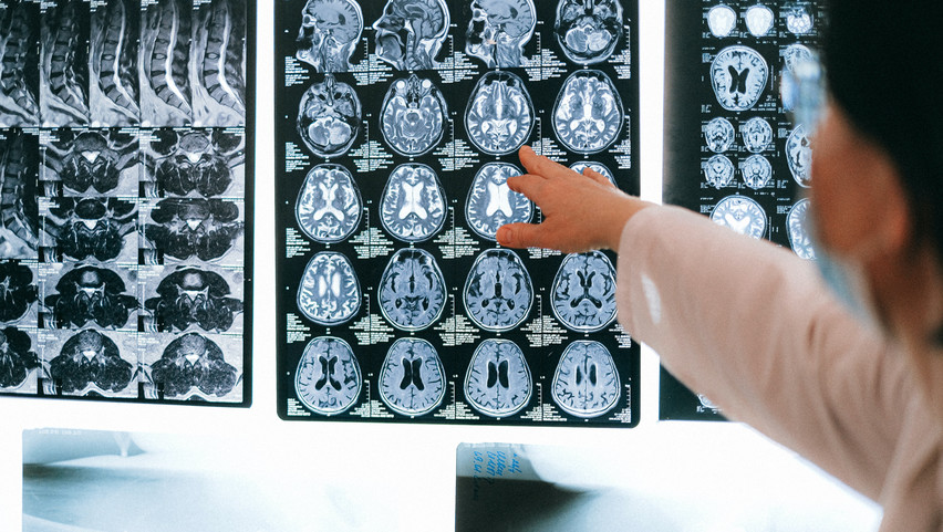 Rejtélyes idegrendszeri betegség bukkant fel Kanadában: két éve tudják, mégsem jutottak a nyomára