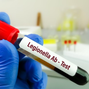 Legionárius betegség, legionellosis