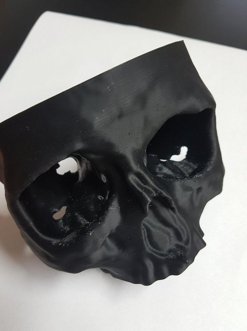 Mam czaszkę dzięki drukarce 3D