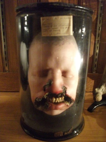 W zbiorach muzealnych można też zobaczyć ofiarę syfilisu.