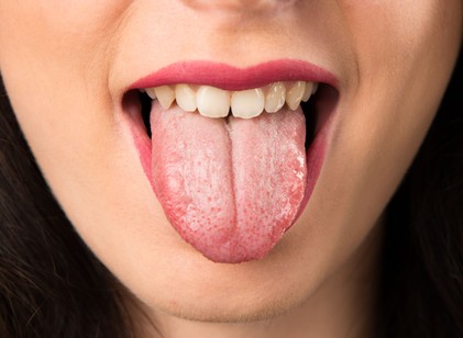 Nem fáj, nem fertőz – mégis sokakat megijeszt: mi is az a térképnyelv? című cikk nyitóképe