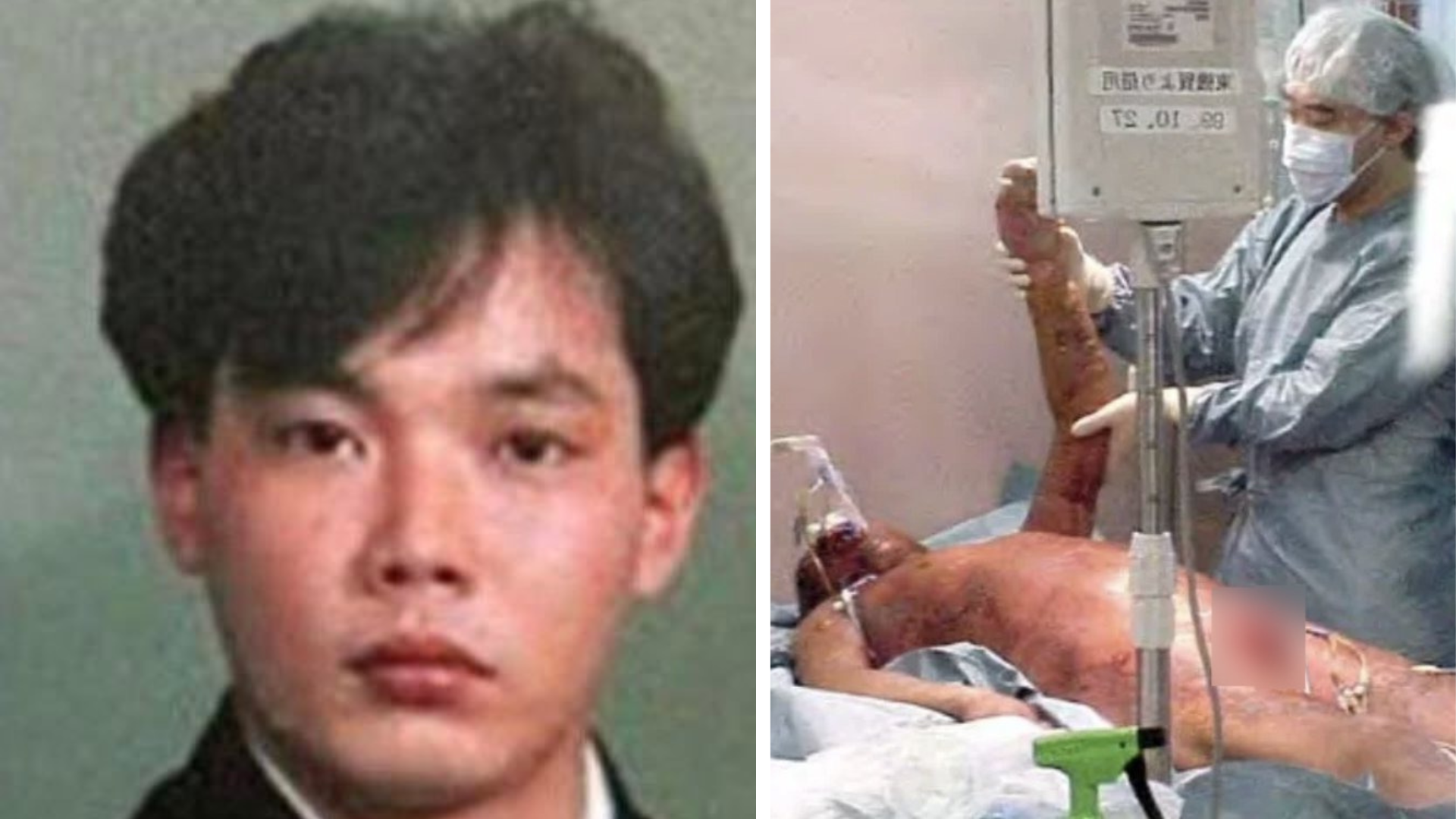 Muž 83 dní žil v agónii.