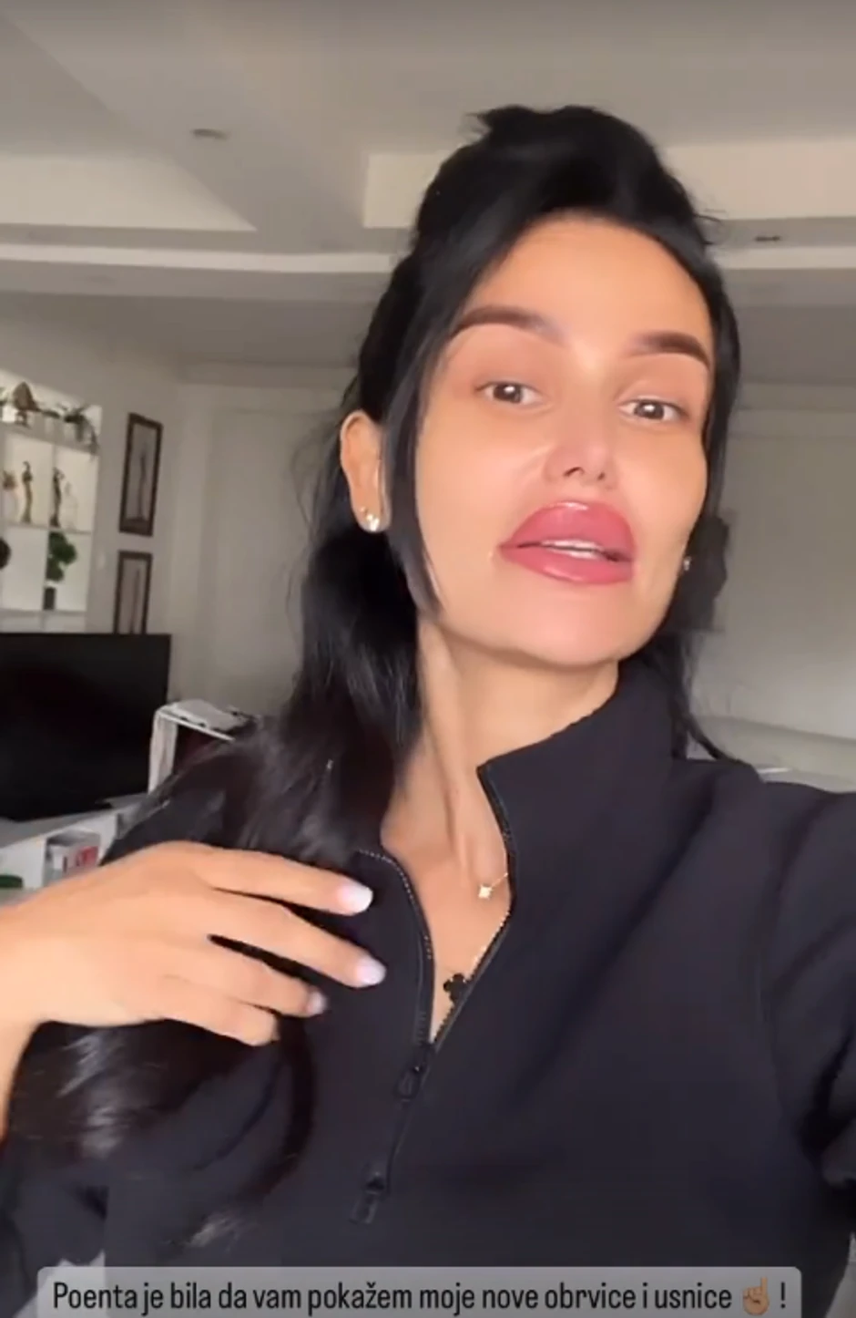 Indi Aradinović korigovala usne i obrve