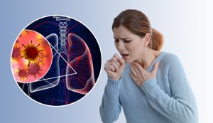 Kašalj je veoma čest simptom raka pluća