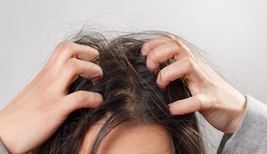 Kraste na temenu mogu biti posledica niza dermatoloških stanja