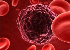 biomarker-daganatsejt-d000015E49aad76248977