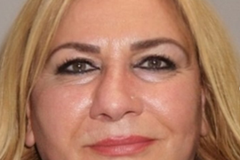 Ovom transformacijom TURCI SU PREVAZIŠLI SAMI SEBE - od sredovečne žene stvorili su NOVU HUREM: U njeno lice nakon samo 5 INTERVENCIJA ljudi gledaju bez treptaja