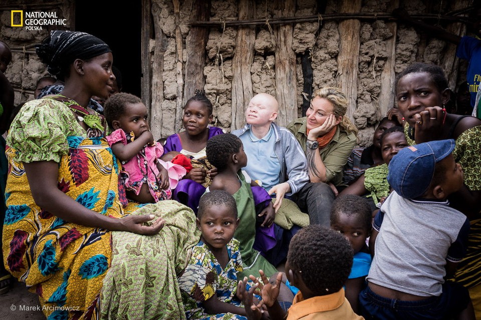 Ludzie duchy - jak bielactwo determinuje życie w Tanzanii