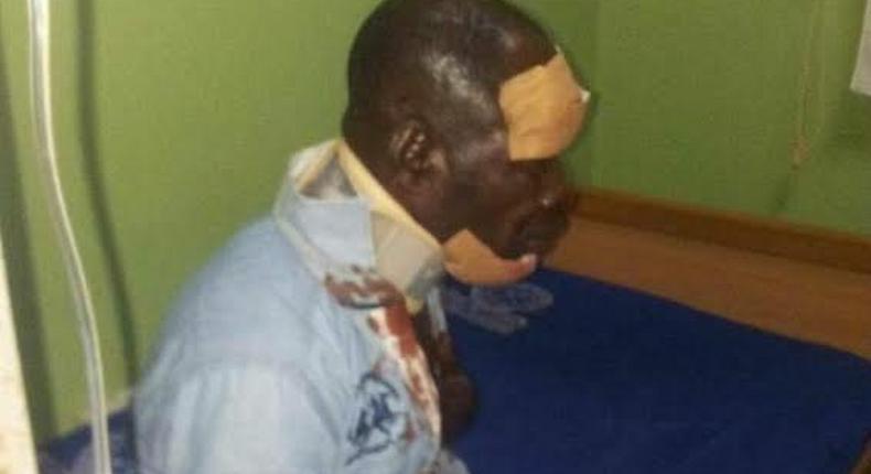 Amakye Dede survives deadly accident