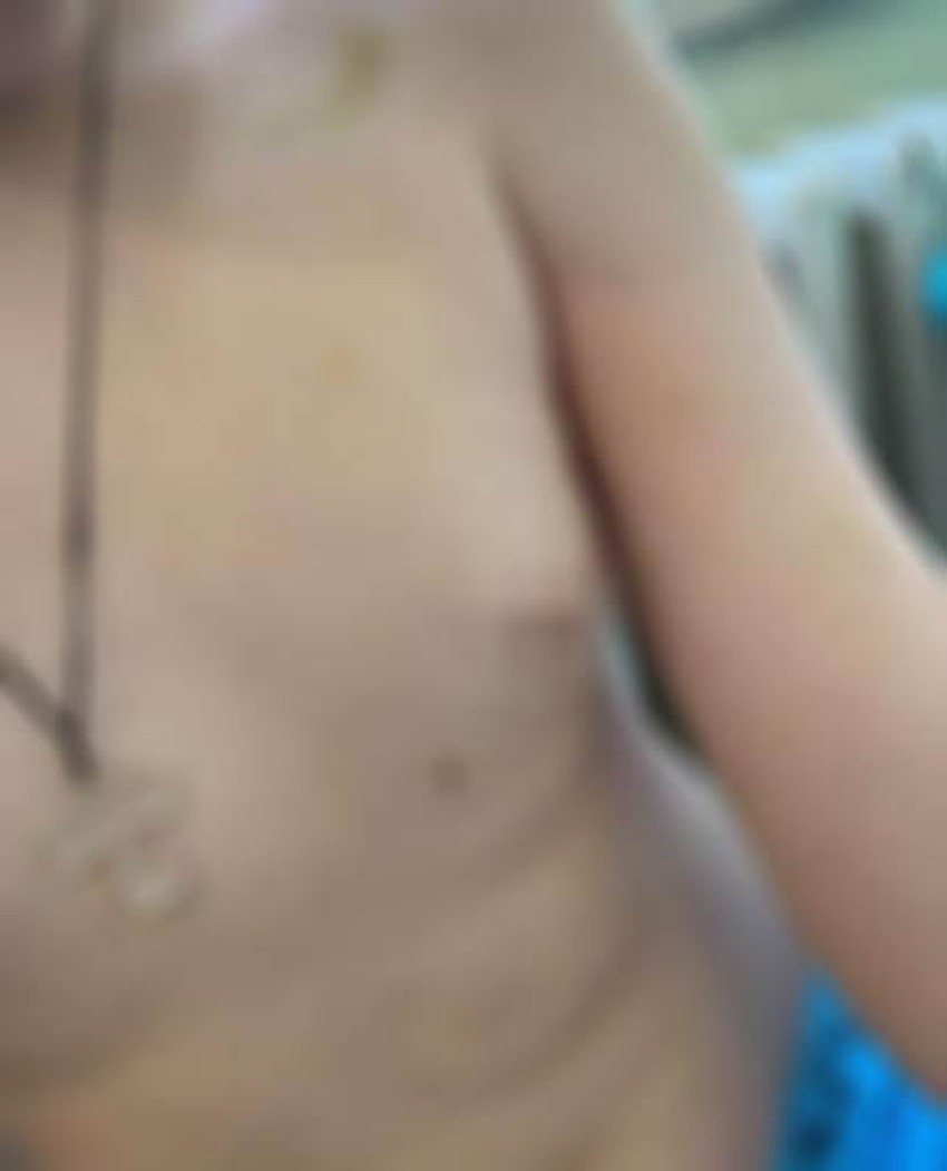 Vršnjačko nasilje na ekskurziji