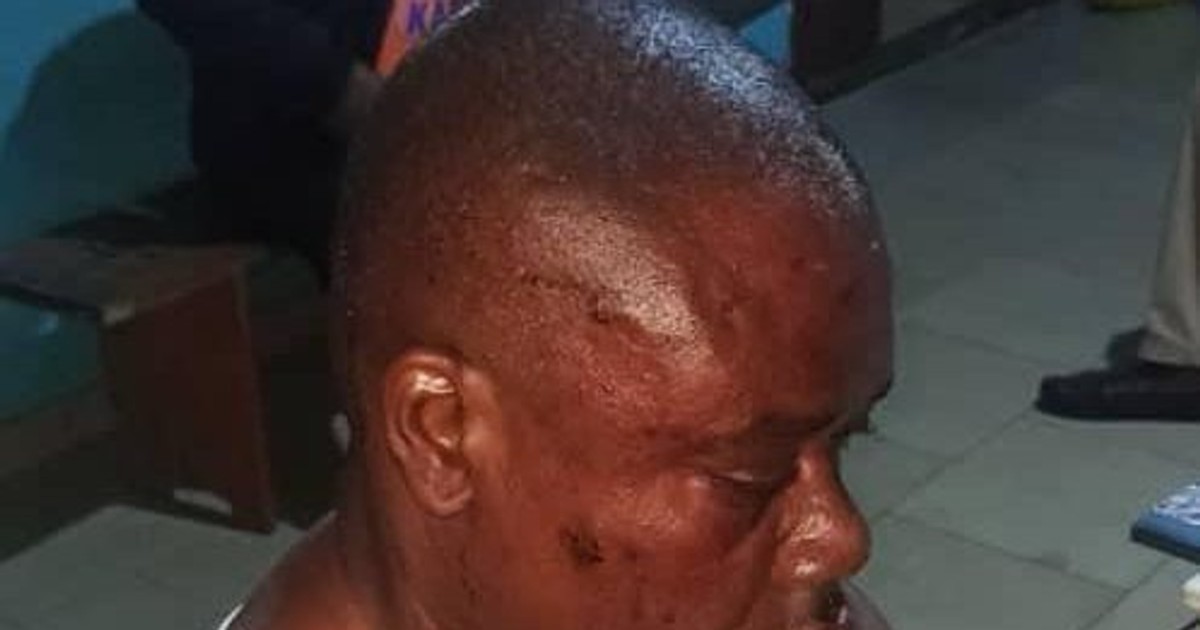Tension in Bayelsa as PDP, APC supporters clash over election materials - Vimarsana News