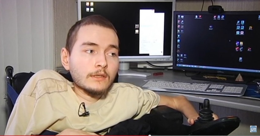 Valerij Spiridonov čeka presađivanje glave