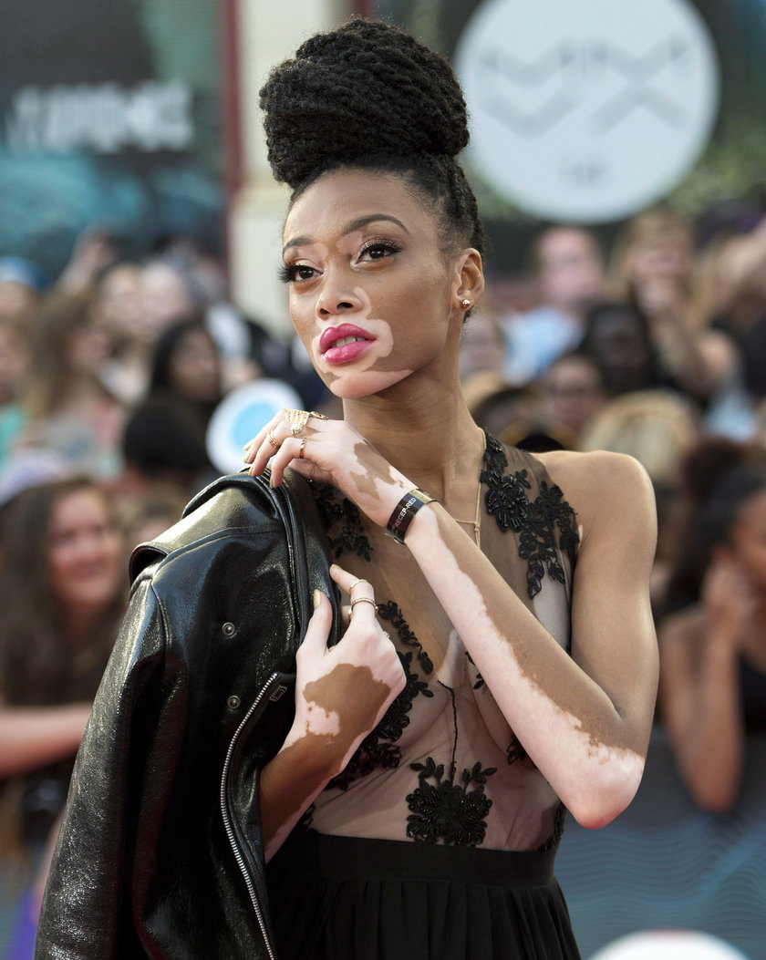 Winnie Harlow