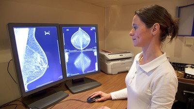 Radiology technician reviewing mammography results