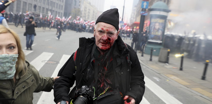 Marsz Niepodległości. Policja zajmie się sprawą postrzelonego fotoreportera