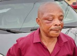 NLC president battling to save right eye in hospital after Imo pummeling