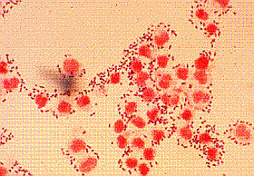 streptococcus-pneumoniae-d000011E030878bd81906