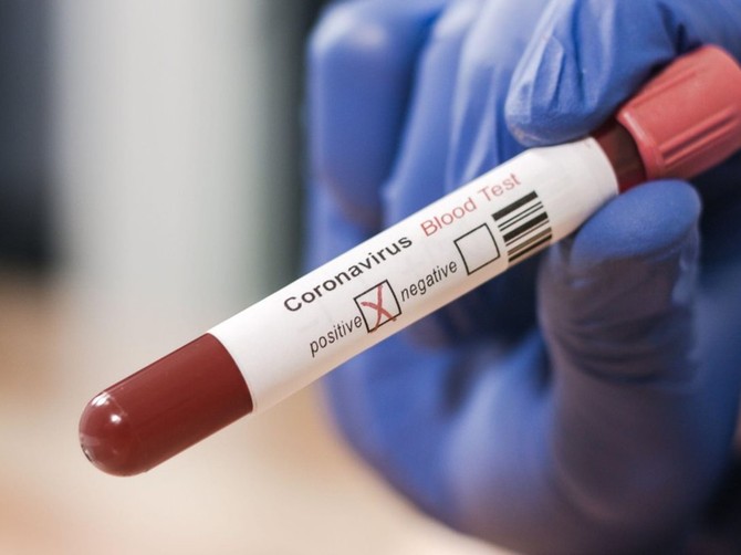 Korona virus