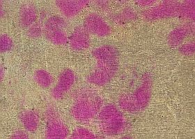 meningococcus-d0000159747eb38dd996c
