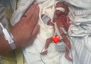 Naš je bio veličine dlana