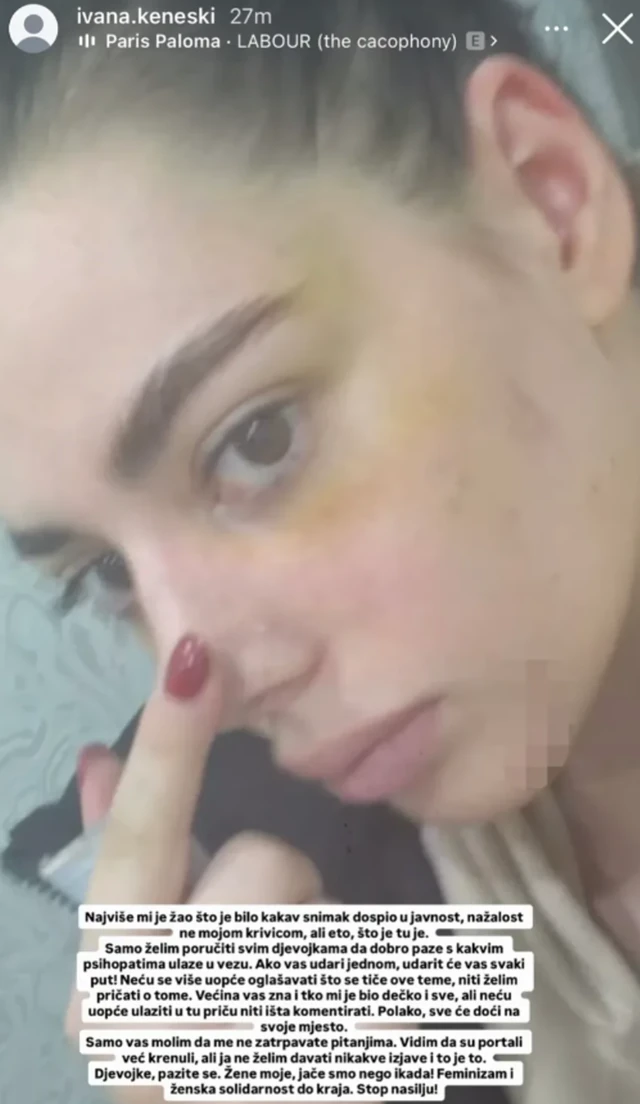 Bivša zadrugarka podelila jezive fotografije nakon što je pretučena