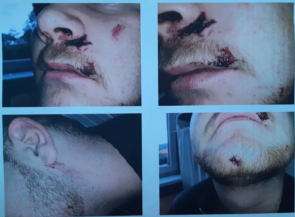 Lebane, mladić pretučen 