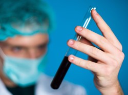 Matko, oddasz krew? Możesz pomóc chorym na raka