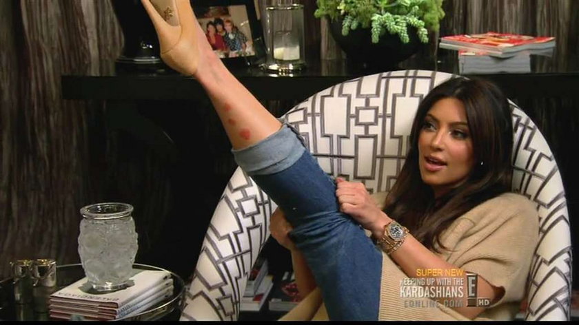 Kim Kardashian i jej wstydliwa choroba. Ma to po mamie
