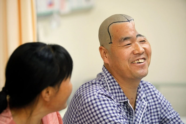 Hu će posle operacije izgledati kao pre nesreće FOTO: Profimedia.rs