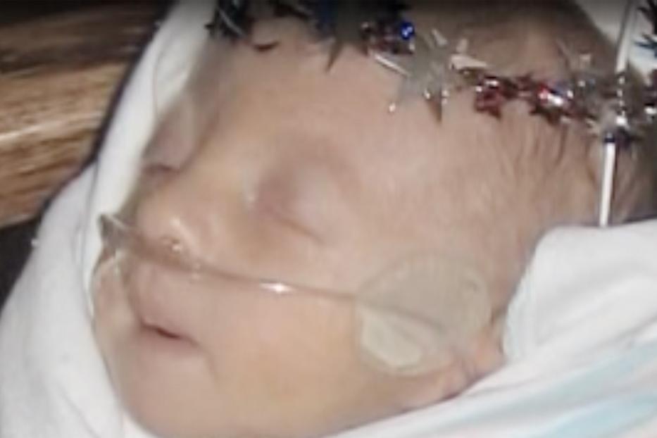 Az orvosok azt mondták, a baba nem éli túl a születést. Még ők is ledöbbentek azon, ami történt