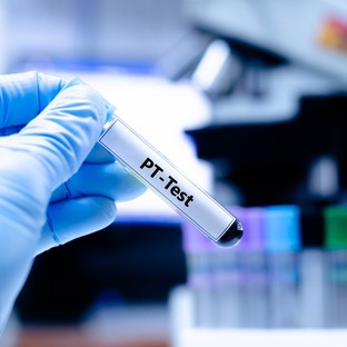Mit jelent a protombin idő (PT) érték a laborleleten?