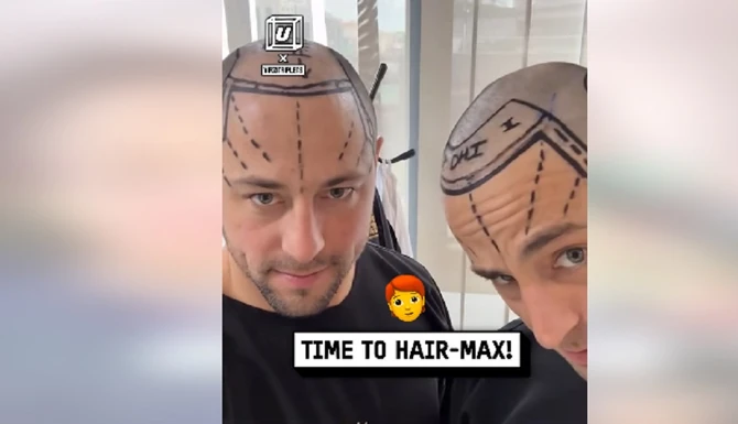 Braća Vizli pred operaciju 