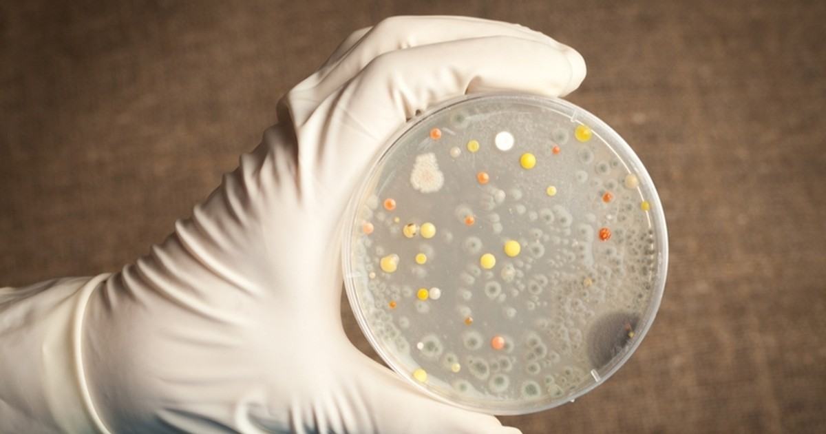 Suspected death from Anthrax outbreak penned in Binduri - Vimarsana News