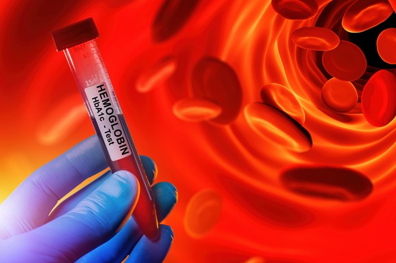 Sedam opasnih nivoa hemoglobina: Značenje kritičnih vrednosti i simptomi koji ih odaju