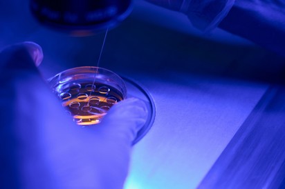 Mire jó a biopszia? Ha egy ilyen vizsgálat után visszahívják, még nem feltétlen jelent rákot