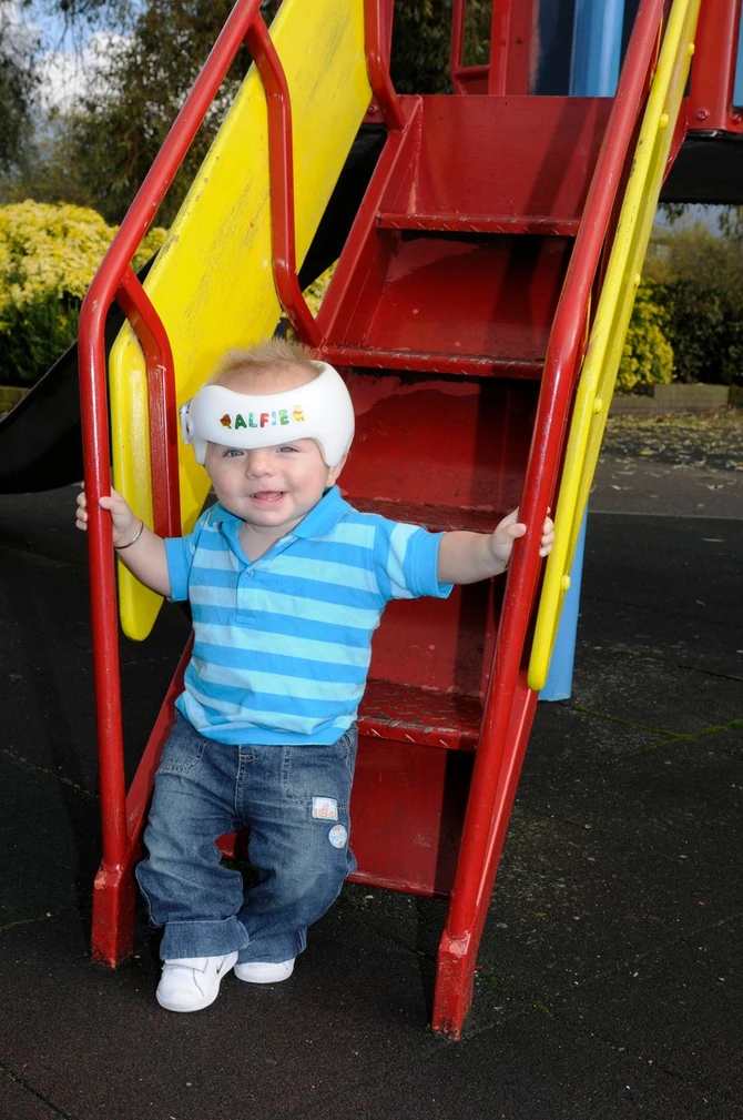 Bebe nose kacige za oblikovanje glave 