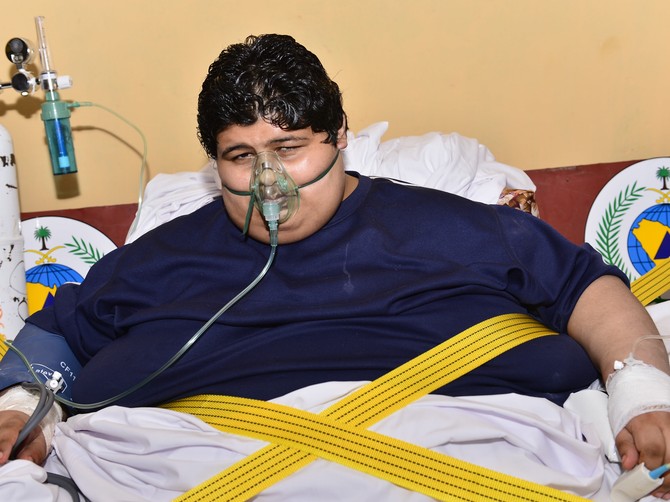 Kalid Bin Mohsen Šari pre operacija i mršavljenja