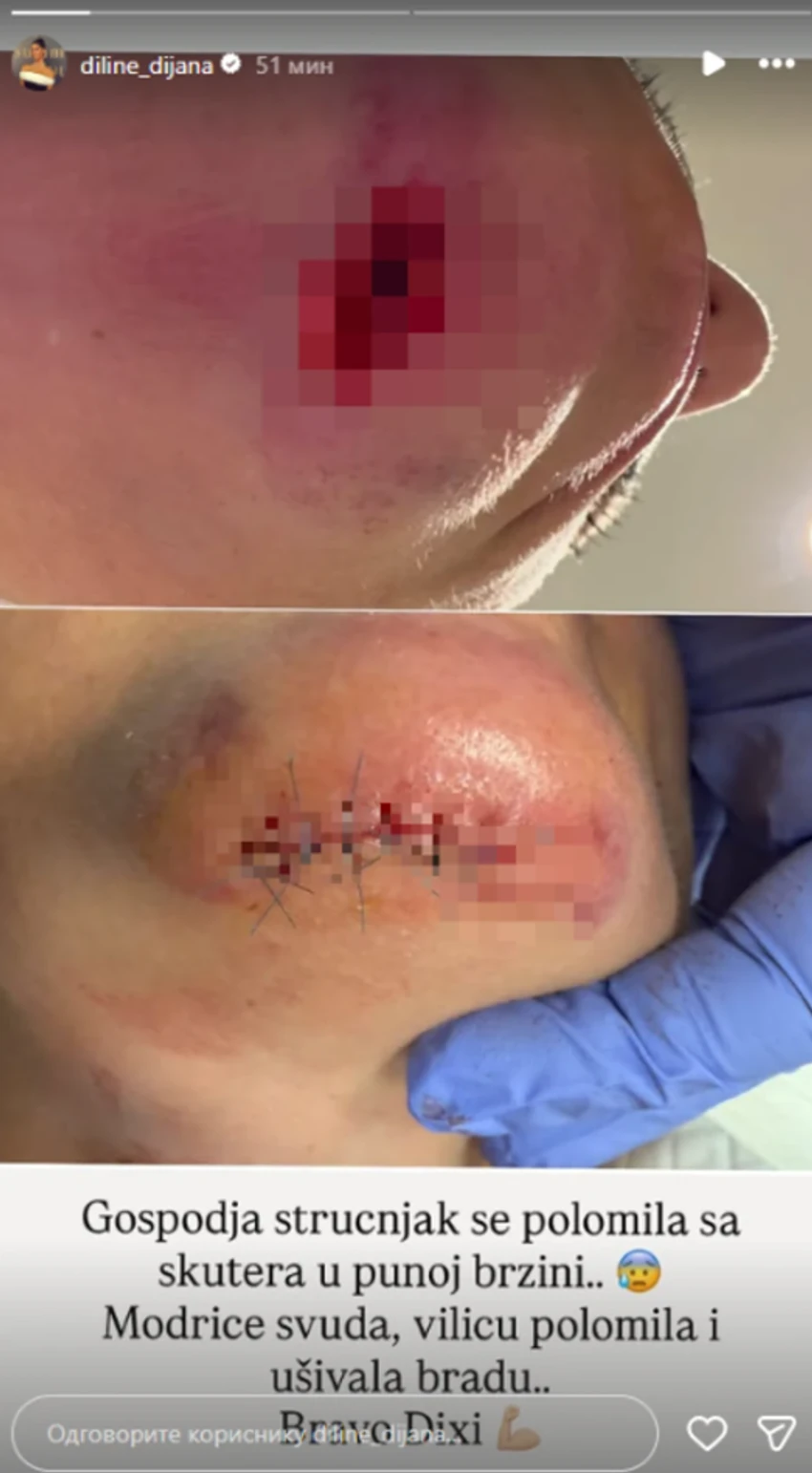 Dijana Diline, objava