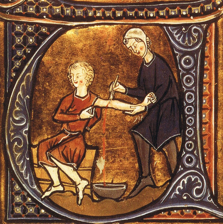 Upuszczanie krwi na średniowiecznej miniaturze