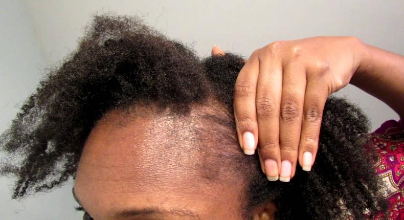 5 simple yet effective ways to protect your natural hair edges