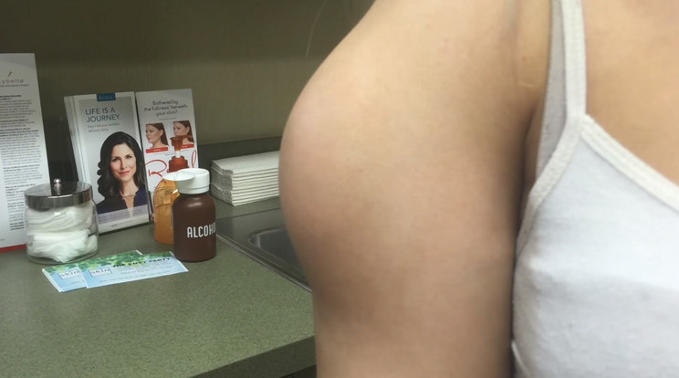 Óriási daganat nőtt a lány karjában/Fotó:Youtube