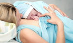 Poród przez cesarskie cięcie naraża dzieci na poważne choroby