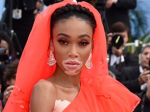 Winnie Harlow akkorát villantott, hogy oda sem merünk nézni, de még így is látjuk...