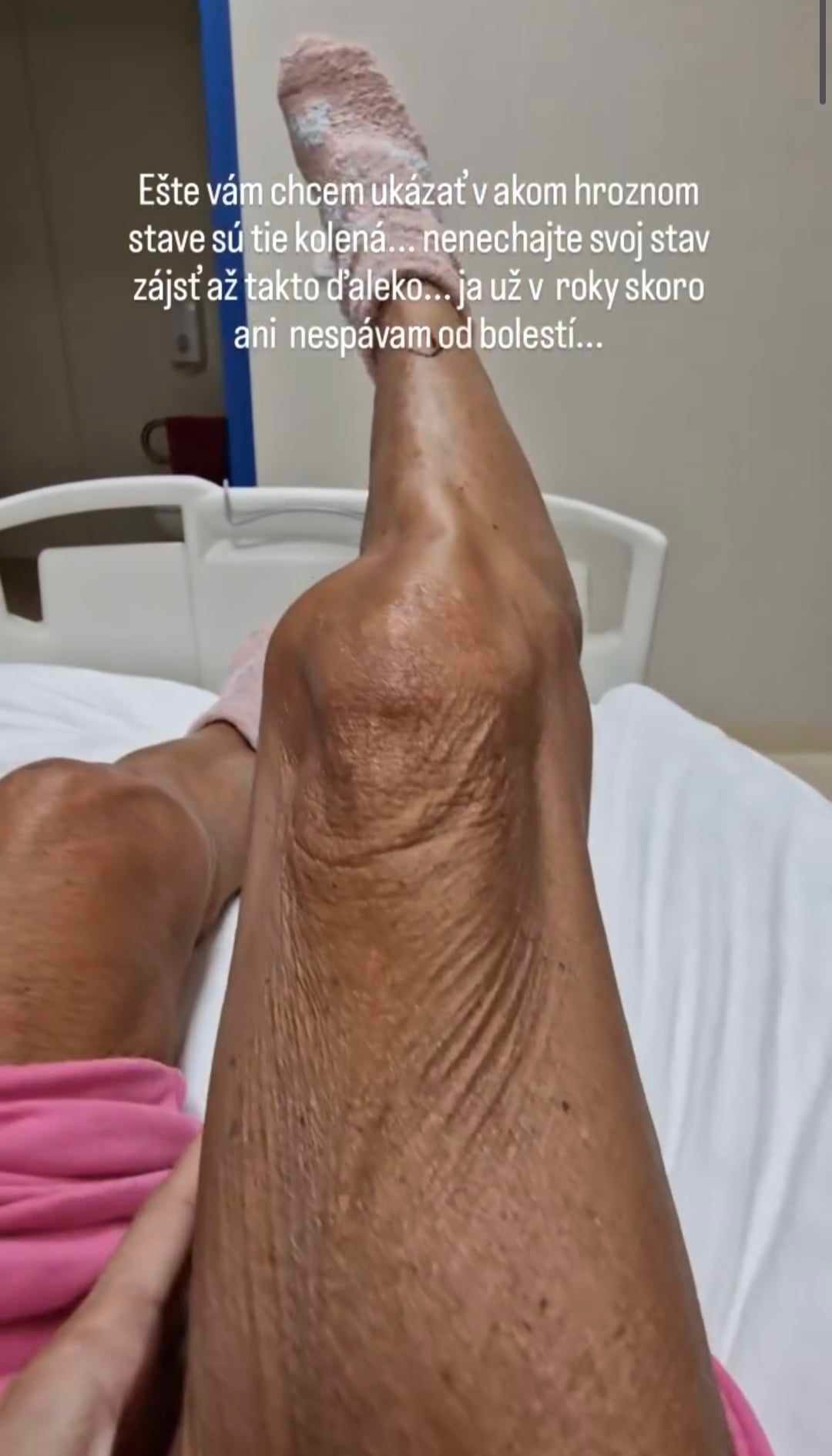 Zora Czoborová podstúpila operáciu kolenných kĺbov.