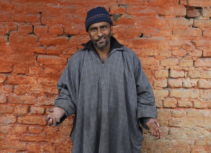 SZPITAL DLA TRĘDOWATYCH W KASZMIRZE